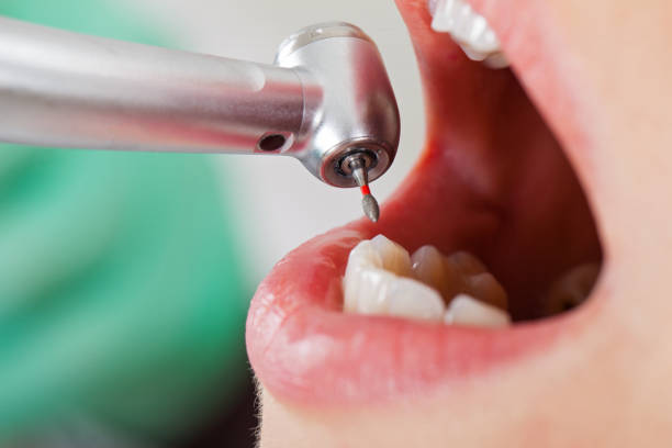 Best Tooth Pain Emergency Relief  in Freeport, TX